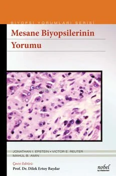 Biyopsilerin Yorumu:Mesane