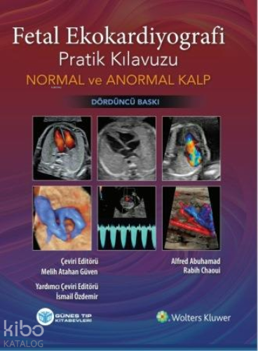 Fetal Ekokardiyografi Pratik Kılavuzu Normal ve Anormal Kalp
