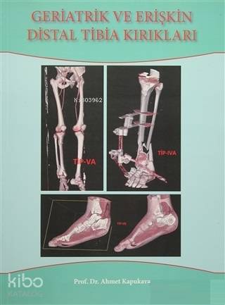 Geriatrik Ve Erişkin Distal Tibia Kırıkları