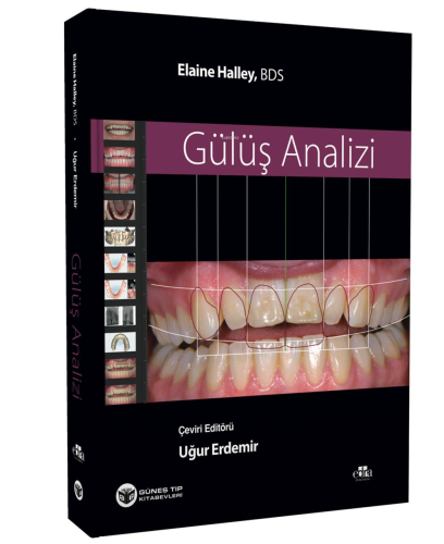 Gülüş Analizi - Kitapiks.com