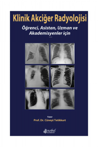 Klinik Akciğer Radyolojisi
