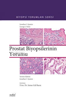 Prostat Biyopsilerinin Yorumu - Kitapiks.com