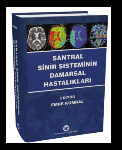 Santral Sinir Sisteminin Damarsal Hastalıkları