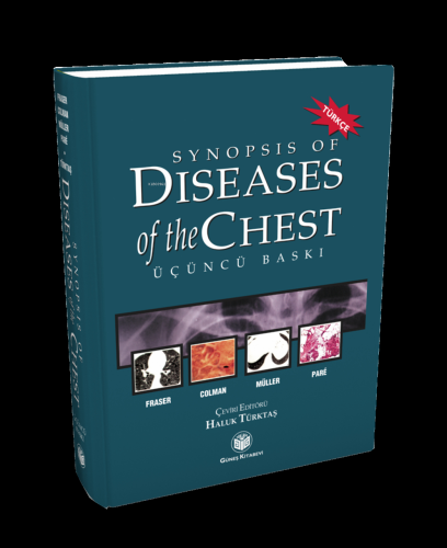 Synopsis of Diseases of The Chest (Türkçesi) - Kitapiks.com