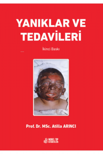 Yanıklar Ve Tedavileri - Kitapiks.com
