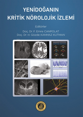 Yenidoğanın Kritik Nöroloji İzlemi